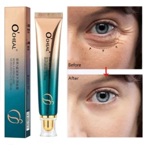 Anti Wrinkle Retinol Eye Cream Anti Dark Circles Eye Bags Removal Moisturizing Eye Creams Eyes Skin Care Products for Beauty 4