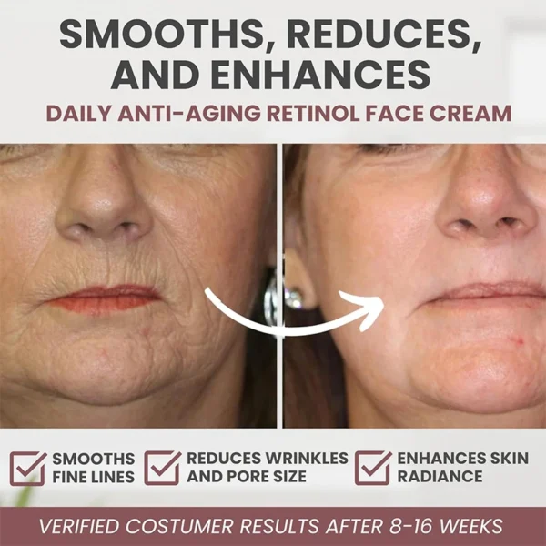 Instant Retinol Cream Wrinkle Remover Firming Lifting Anti Aging Fade Fine Lines Moisturizing Whitening Korea Repair Skin Care 5