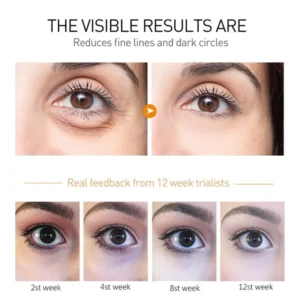 Anti Wrinkle Retinol Eye Cream Anti Dark Circles Eye Bags Removal Moisturizing Eye Creams Eyes Skin Care Products for Beauty 3