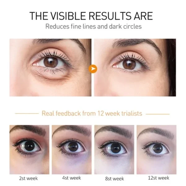 Anti Wrinkle Retinol Eye Cream Anti Dark Circles Eye Bags Removal Moisturizing Eye Creams Eyes Skin Care Products for Beauty 3