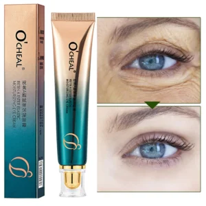 Anti Wrinkle Retinol Eye Cream Anti Dark Circles Eye Bags Removal Moisturizing Eye Creams Eyes Skin Care Products for Beauty 5