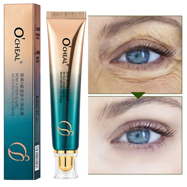 Anti Wrinkle Retinol Eye Cream Anti Dark Circles Eye Bags Removal Moisturizing Eye Creams Eyes Skin Care Products for Beauty 5