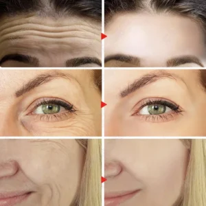 Original Remove Wrinkle Face Set Firming Lifting Anti-Aging Serum  Fade Fine Lines Eye stick Improve Puffiness Korean Skin Care 2