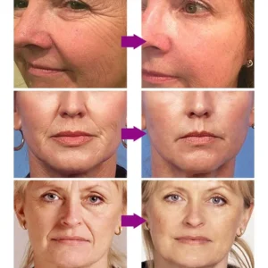 Original Remove Wrinkle Face Set Firming Lifting Anti-Aging Serum  Fade Fine Lines Eye stick Improve Puffiness Korean Skin Care 3